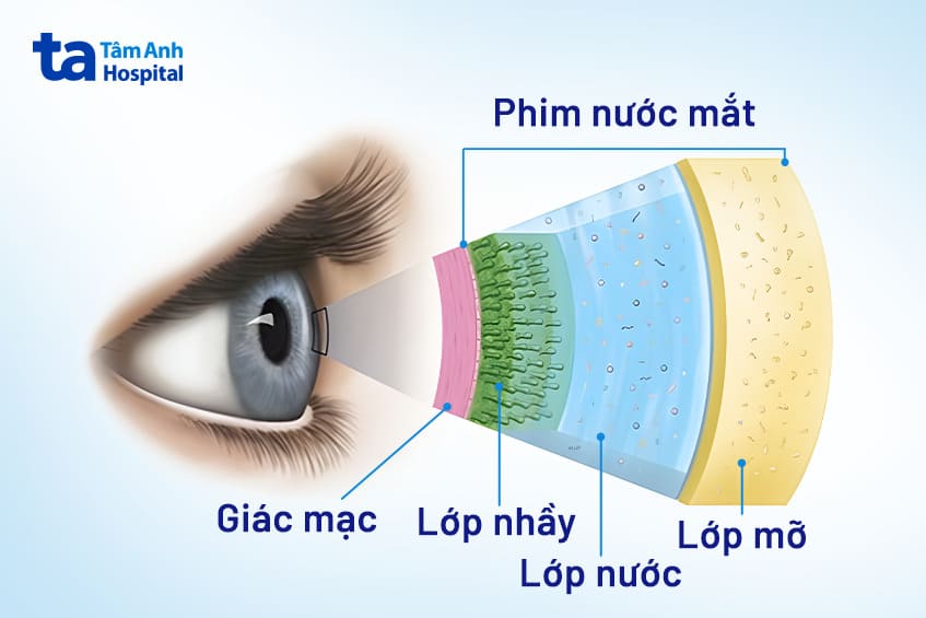 Cách Trị Khô Mắt