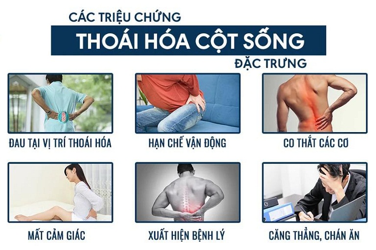 Dấu Hiệu Thoái Hóa Cột Sống