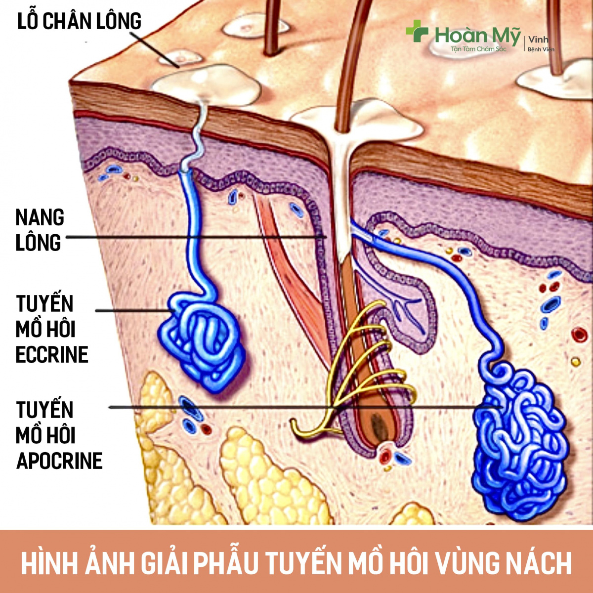 Hôi Nách Là Gì