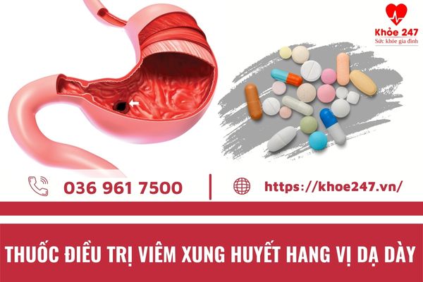 Thuốc điều Trị Viêm Xung Huyết Hang Vị Dạ Dày