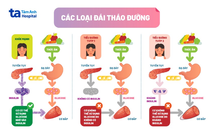 Trẻ Em Có Bị Tiểu đường Không