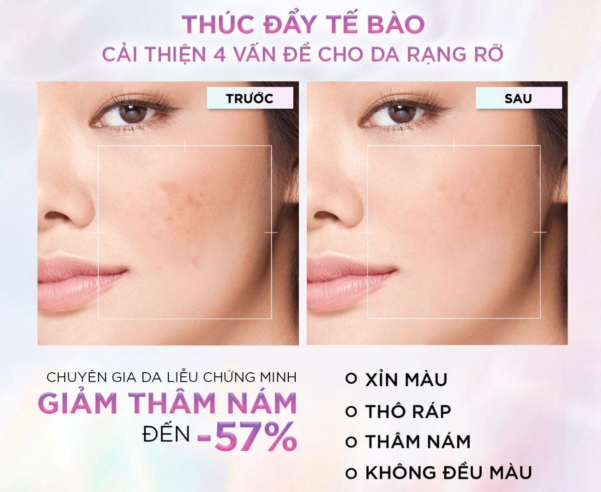 Trị Thâm Nám