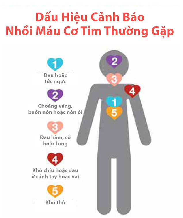 Triệu Chứng Của Nhồi Máu Cơ Tim