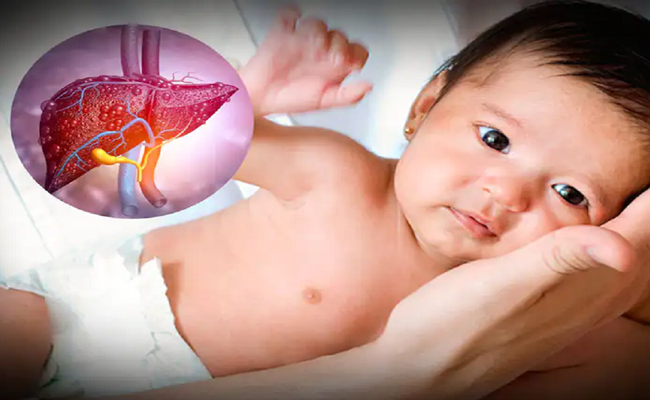 Viêm Gan Cấp Tính ở Trẻ Em