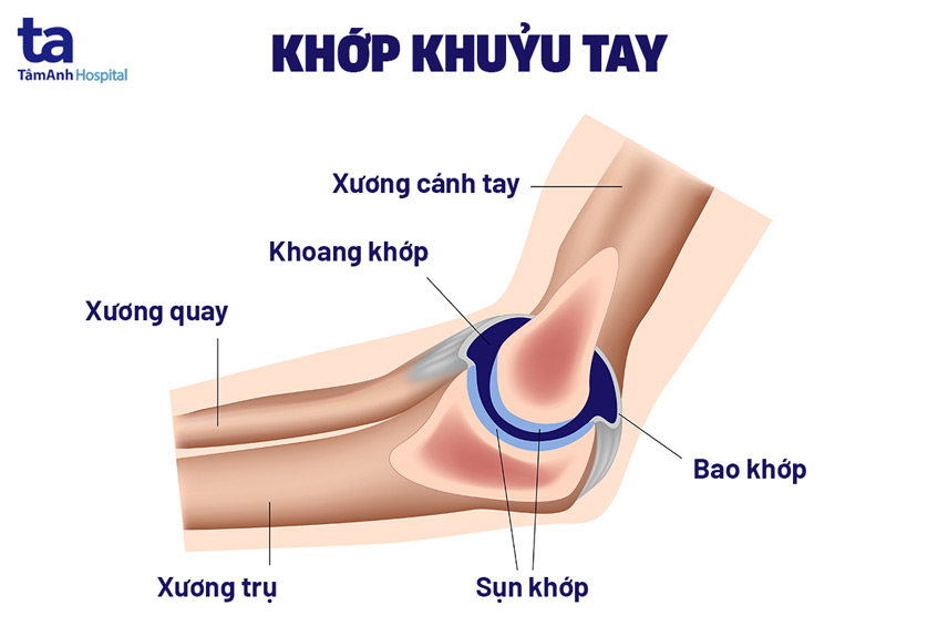 Viêm Khớp Khuỷu Tay
