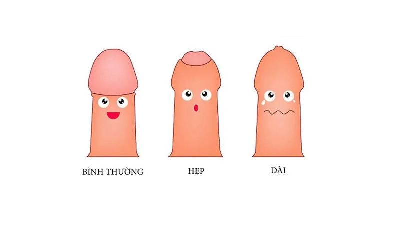 Bao Quy đầu Dài Hẹp