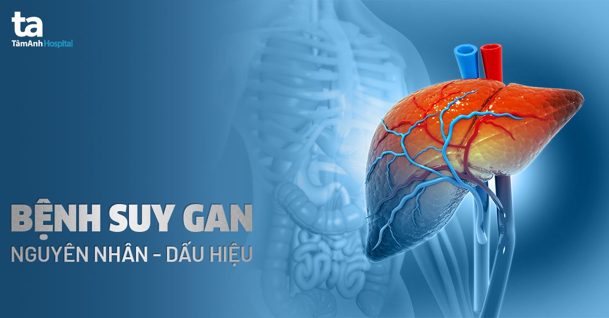 Bệnh Suy Gan