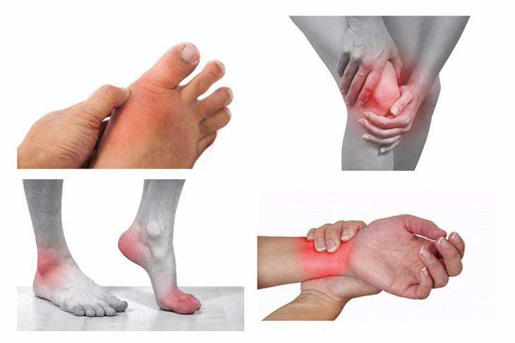 đau Cách Hồi