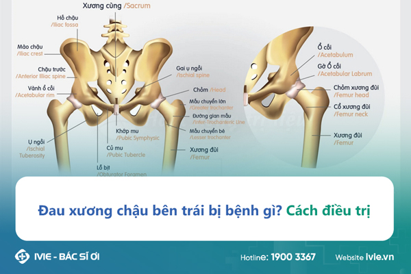 đau Xương Chậu Bên Trái Nữ