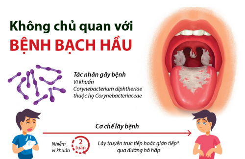 Dịch Bạch Hầu Là Gì