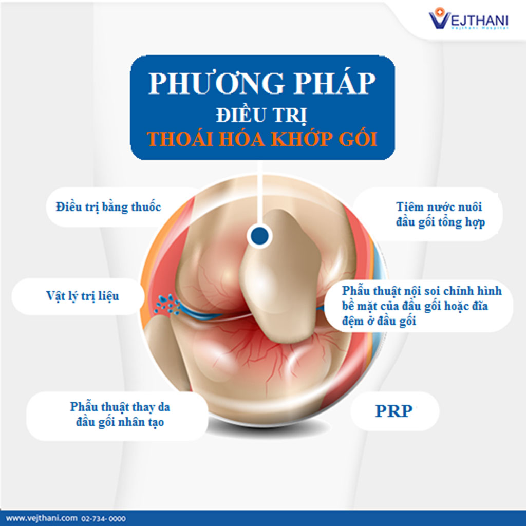 điều Trị Thoái Hóa Khớp