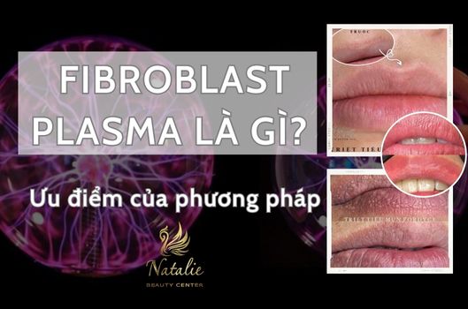 Fibroblast Là Gì