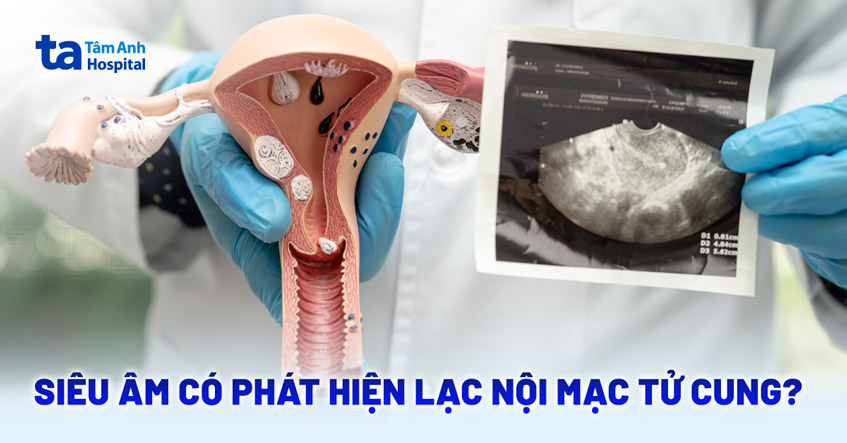Hình ảnh Lạc Nội Mạc Tử Cung