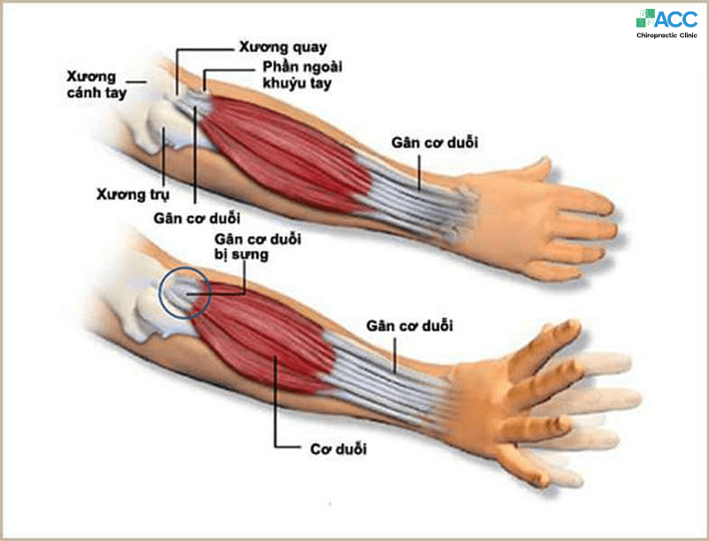 Khủy Tay Là Gì