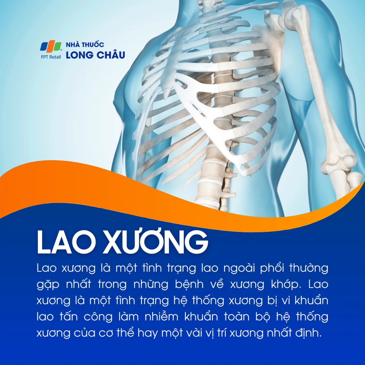 Lao Xương Là Bệnh Gì