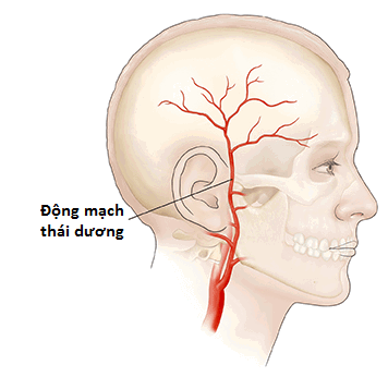 Mạch Máu ở Thái Dương đập Mạnh