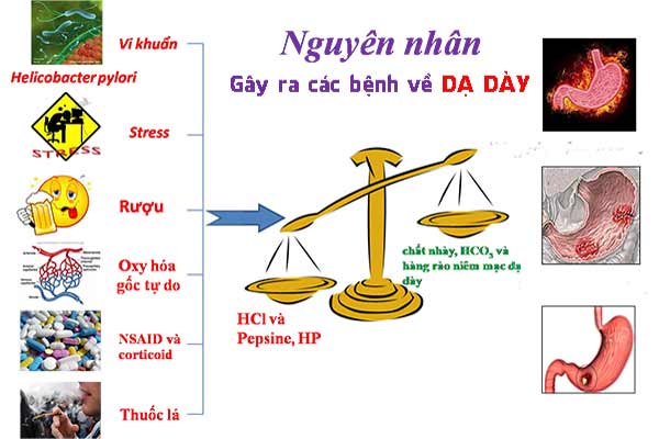 Nguyên Nhân Gây Viêm Loét Dạ Dày