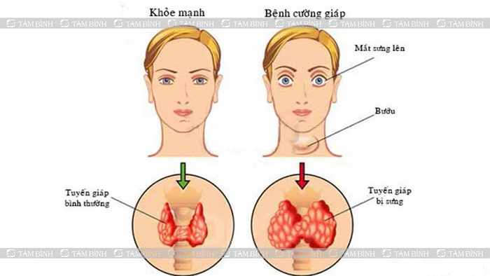 Nguyên Nhân Nóng Trong Người