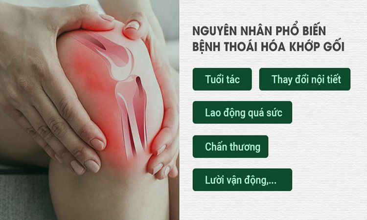 Nguyên Nhân Thoái Hóa Khớp