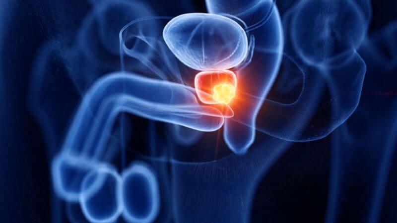 Nhiễm Trùng Roi ở Nam Giới