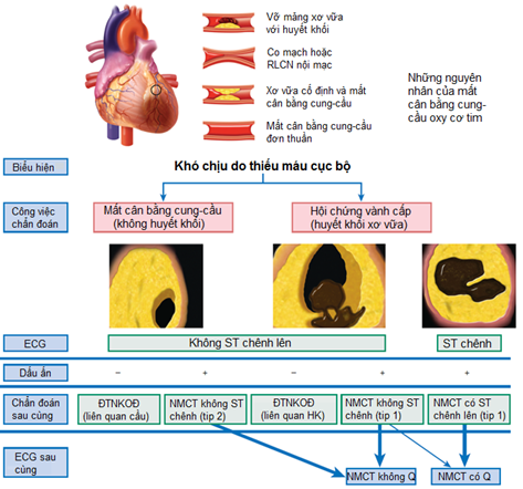 Nhồi Máu Cơ Tim Type 2