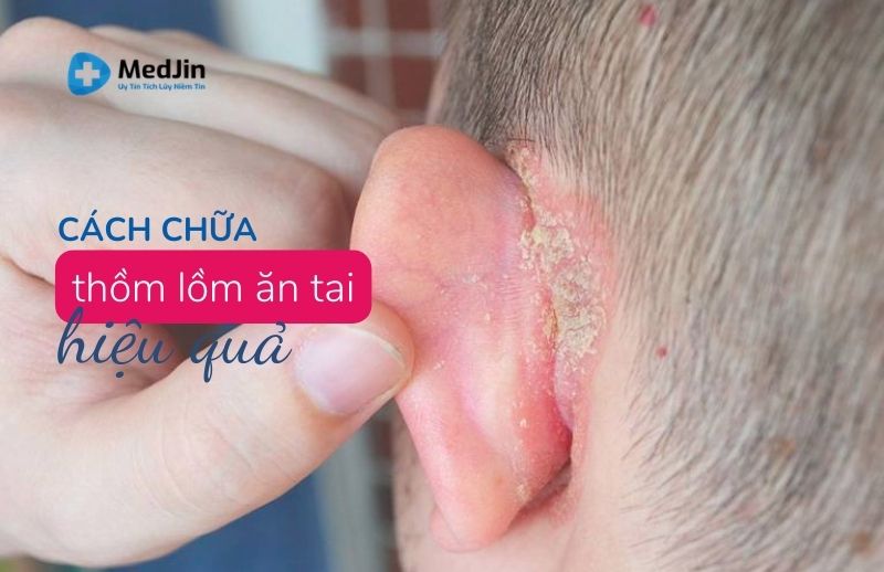 Nồm ăn Tai