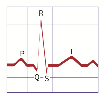 Phức Bộ Qrs