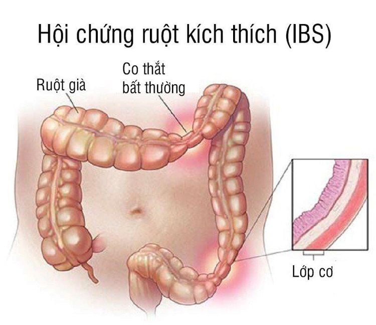Quai Ruột Nhiều Hơi Là Gì