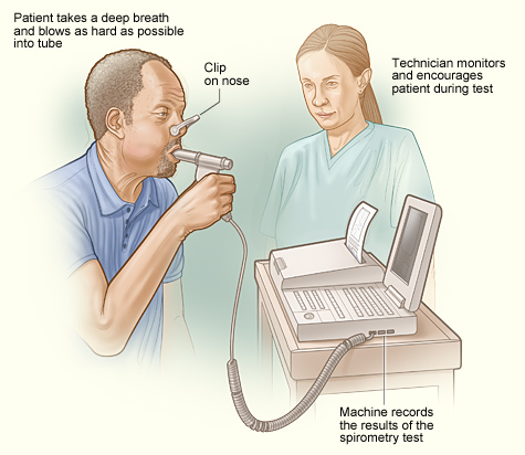 Spirometry Là Gì