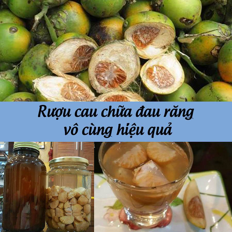 Tác Dụng Của Hạt Cau Ngâm Rượu