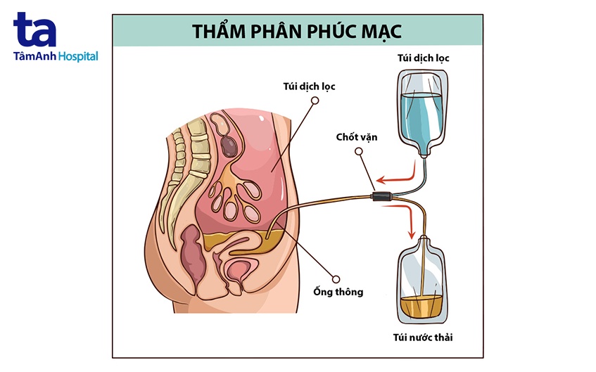 Thẩm Phân Phúc Mạc Là Gì
