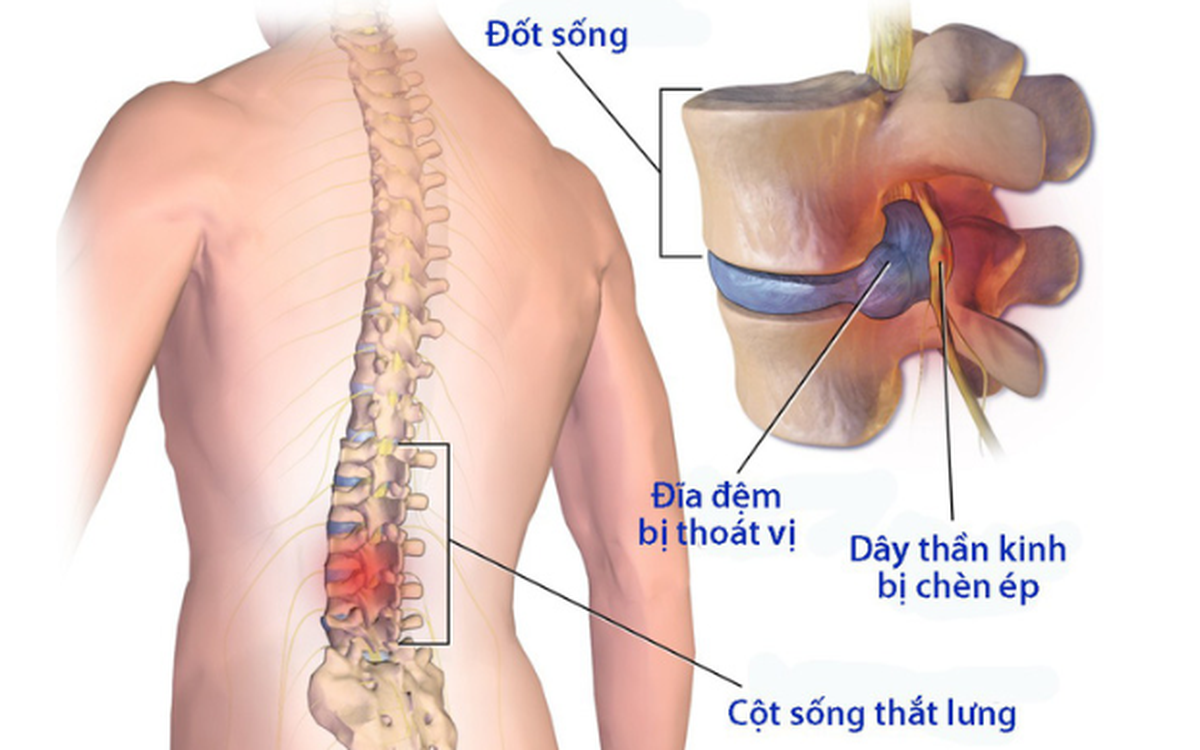 Thần Kinh Liên Sườn Là Gì