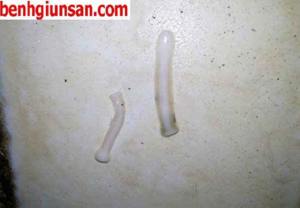 Thuốc đặc Trị Sán Xơ Mít