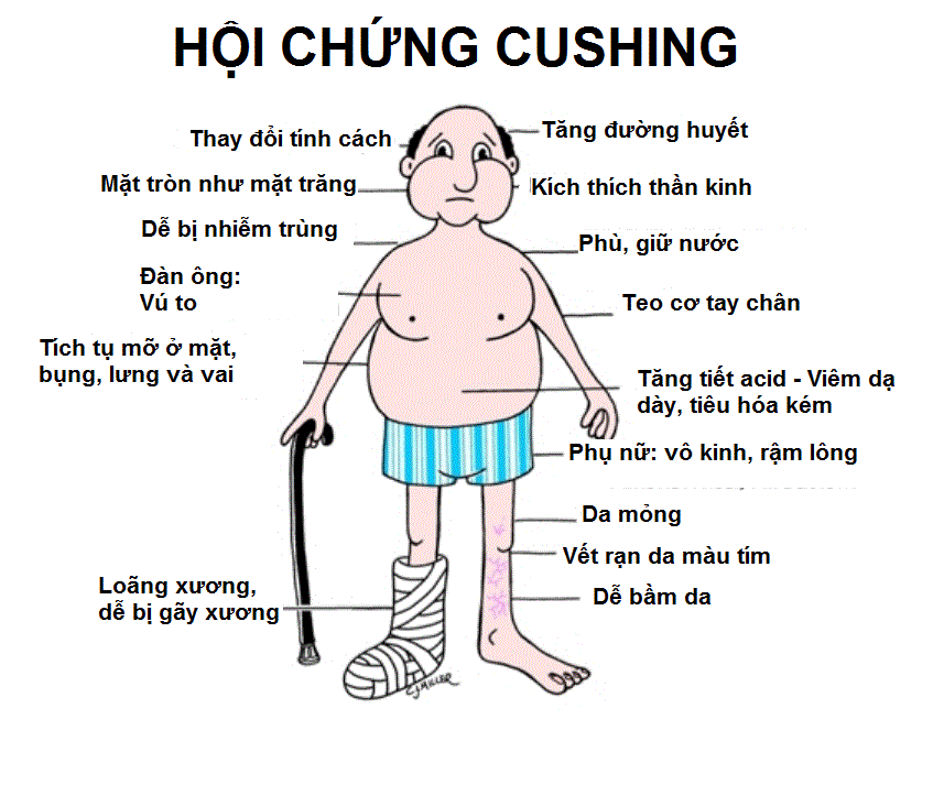 Thuốc điều Trị Hội Chứng Cushing