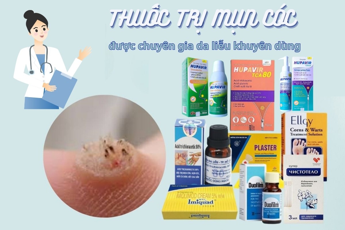 Thuốc Thoa Mụn Cóc