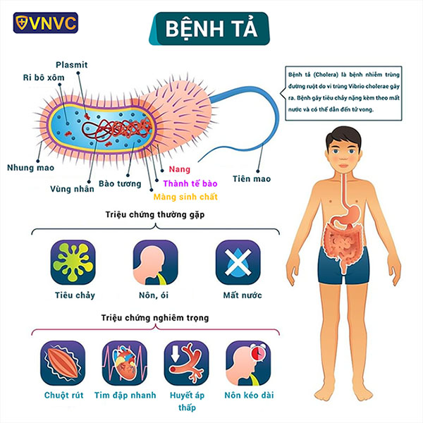 Triệu Chứng Bệnh Tả