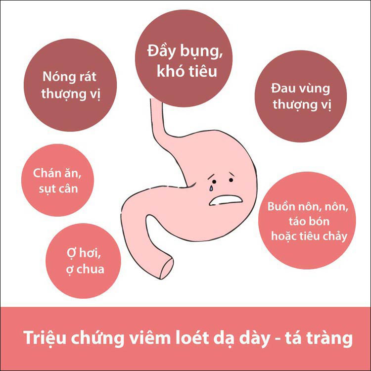 Triệu Chứng Dạ Dày