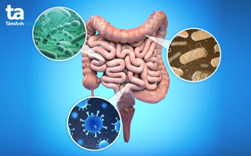Triệu Chứng Nhiễm Trùng đường Ruột