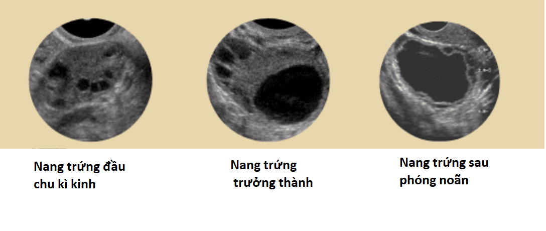Trứng Không Có Noãn