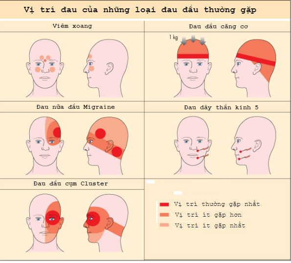 Tự Nhiên đau đầu