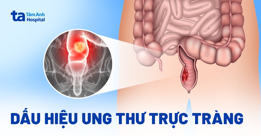 Ung Thu Truc Trang