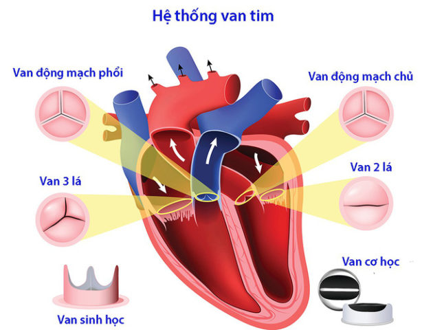 Van Tim Là Gì