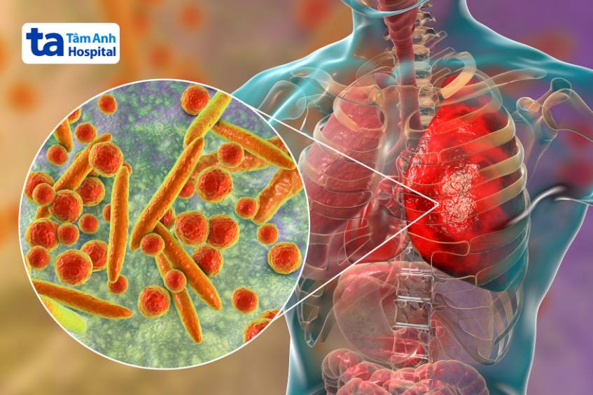 Vi Khuẩn Mycoplasma Pneumoniae