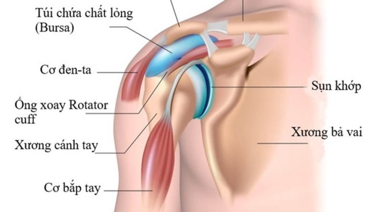 Viêm Bao Hoạt Dịch Khớp Vai
