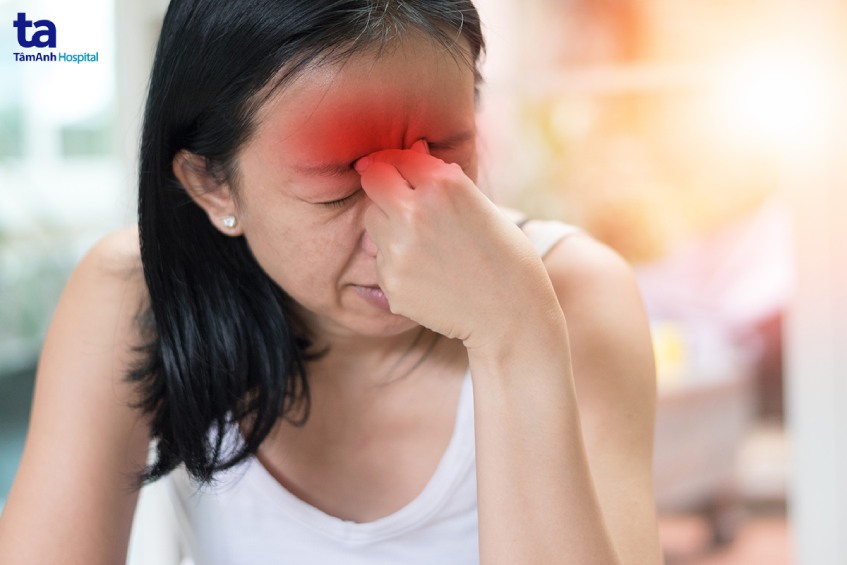Viêm Xoang Cấp Tính Là Gì