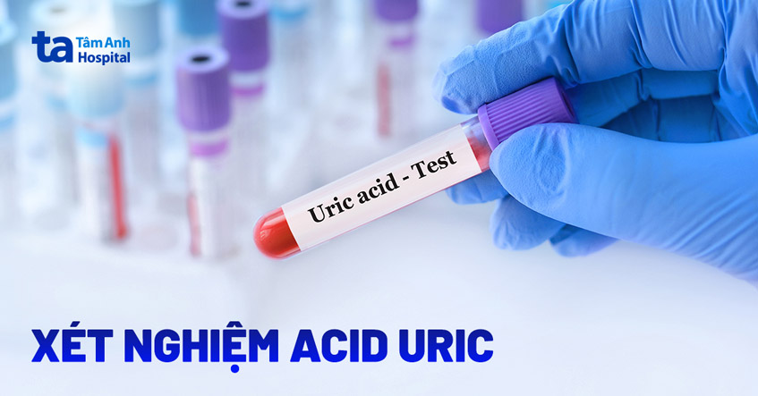 Xét Nghiệm Axit Uric
