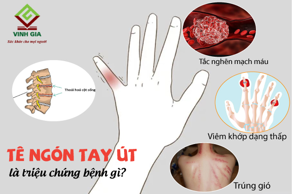 Bệnh Ut Là Gì