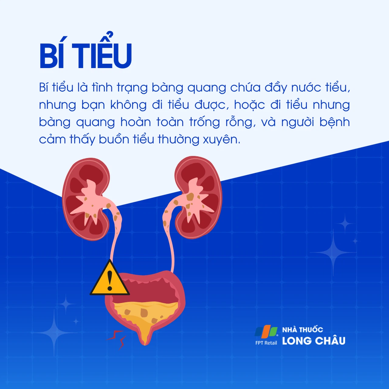 Bí Tiểu Phải Làm Sao