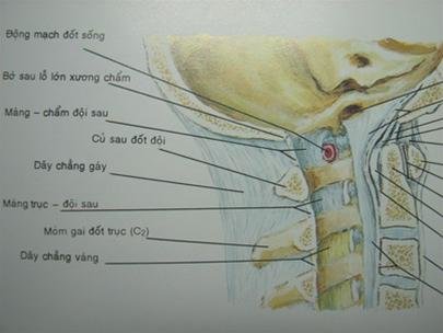 Dây Chằng Vàng