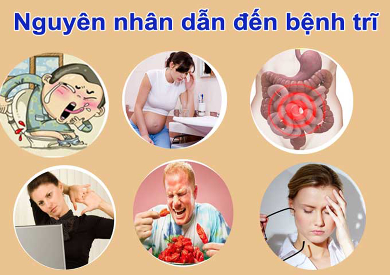 Nguyên Nhân Trĩ